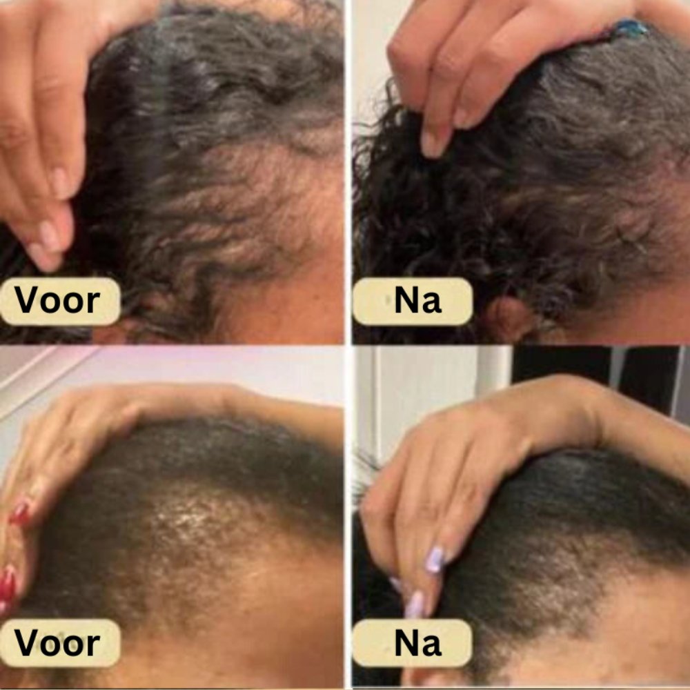 Veganic Natuurlijke Haargroei Olie | 1+1 Gratis!