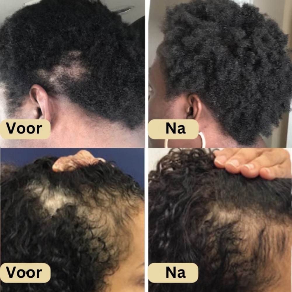 Veganic Natuurlijke Haargroei Olie | 1+1 Gratis!