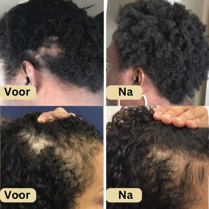 Veganic Natuurlijke Haargroei Olie | 1+1 Gratis!